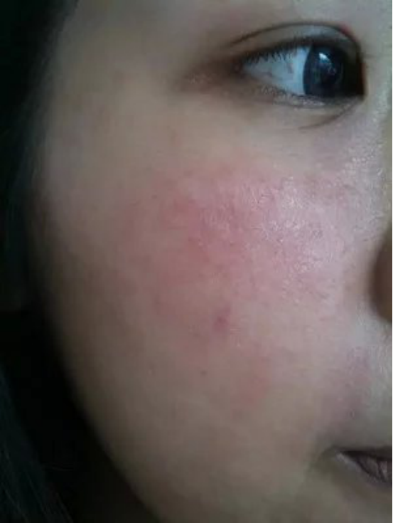 健康风险评估系统_基因检测健康风险高_化妆品的健康风险